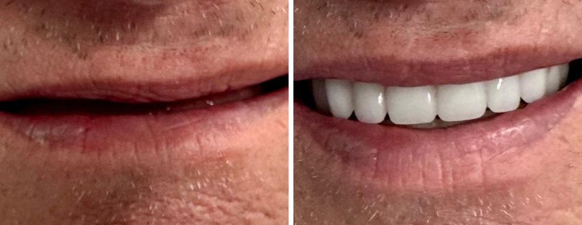 Family & Cosmetic Dentist in Buford, GA